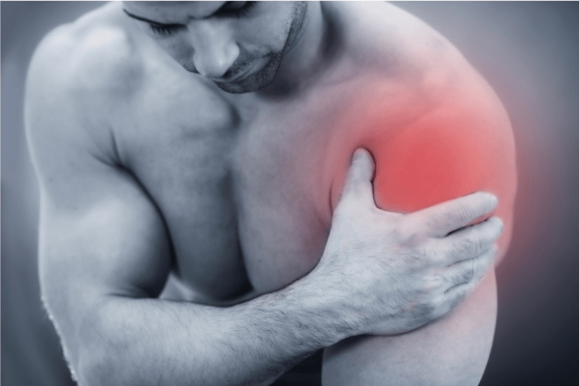 Rotator cuff pain β 1 image 21