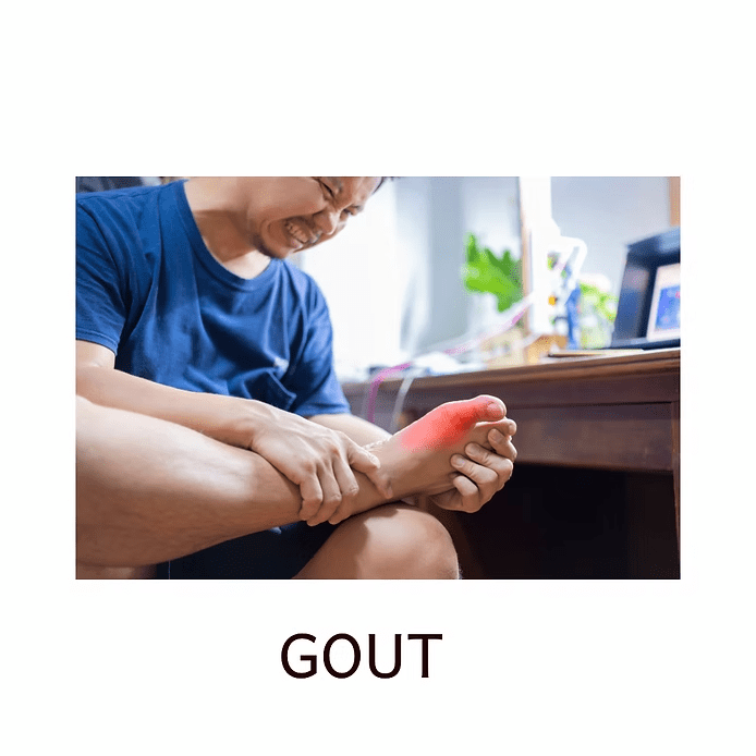GOUT? 1 image 13